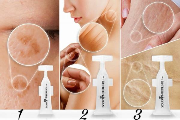 Phi Body Microneedling Gel 5/1